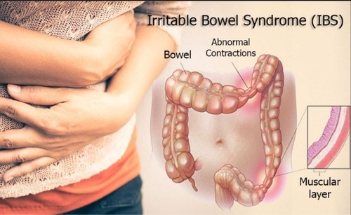 full form of ibs